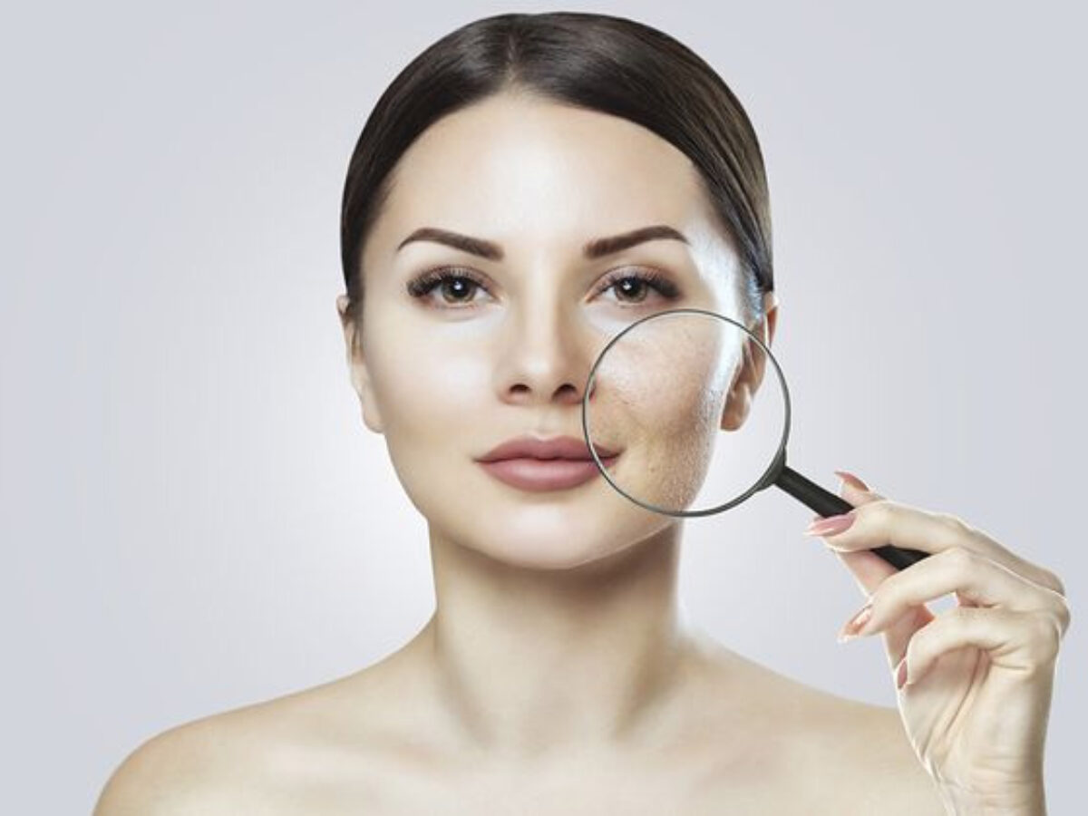 臉出油又脫屑？ 你以為的混和敏感肌可能是脂漏性皮膚炎！ - oaoa 敏感肌教室