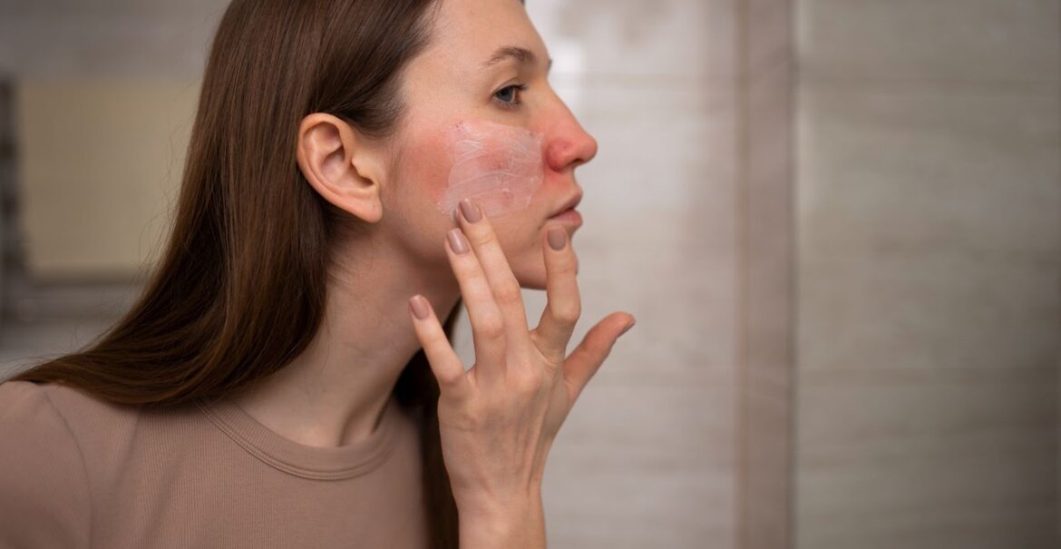 痤瘡是什麼？皮膚科醫師教你正確痤瘡治療、保養、預防